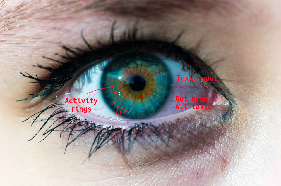 iridology_exampleiris.jpg iridology_exampleiris.jpg