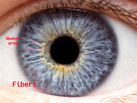 iridology_irisfibers.jpg iridology_irisfibers.jpg
