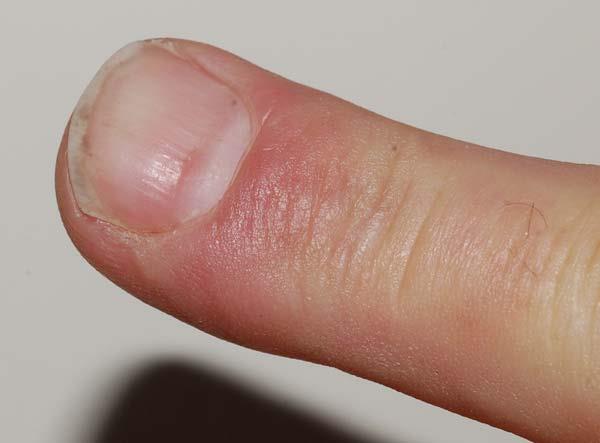 pdn20_finger-1.jpg